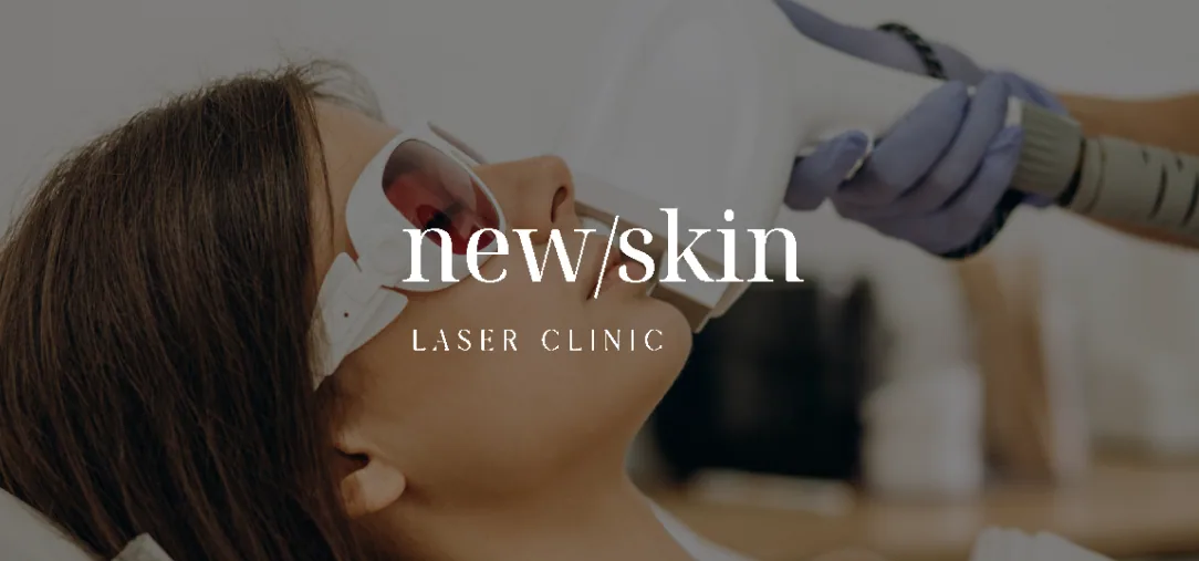 New Skin Laser — project presentation